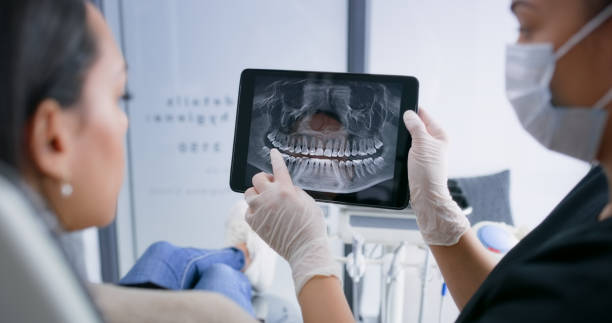 Licensed Tooth Extraction service in William Paterson University of New Jersey, NJ - Smile Center Dentistry